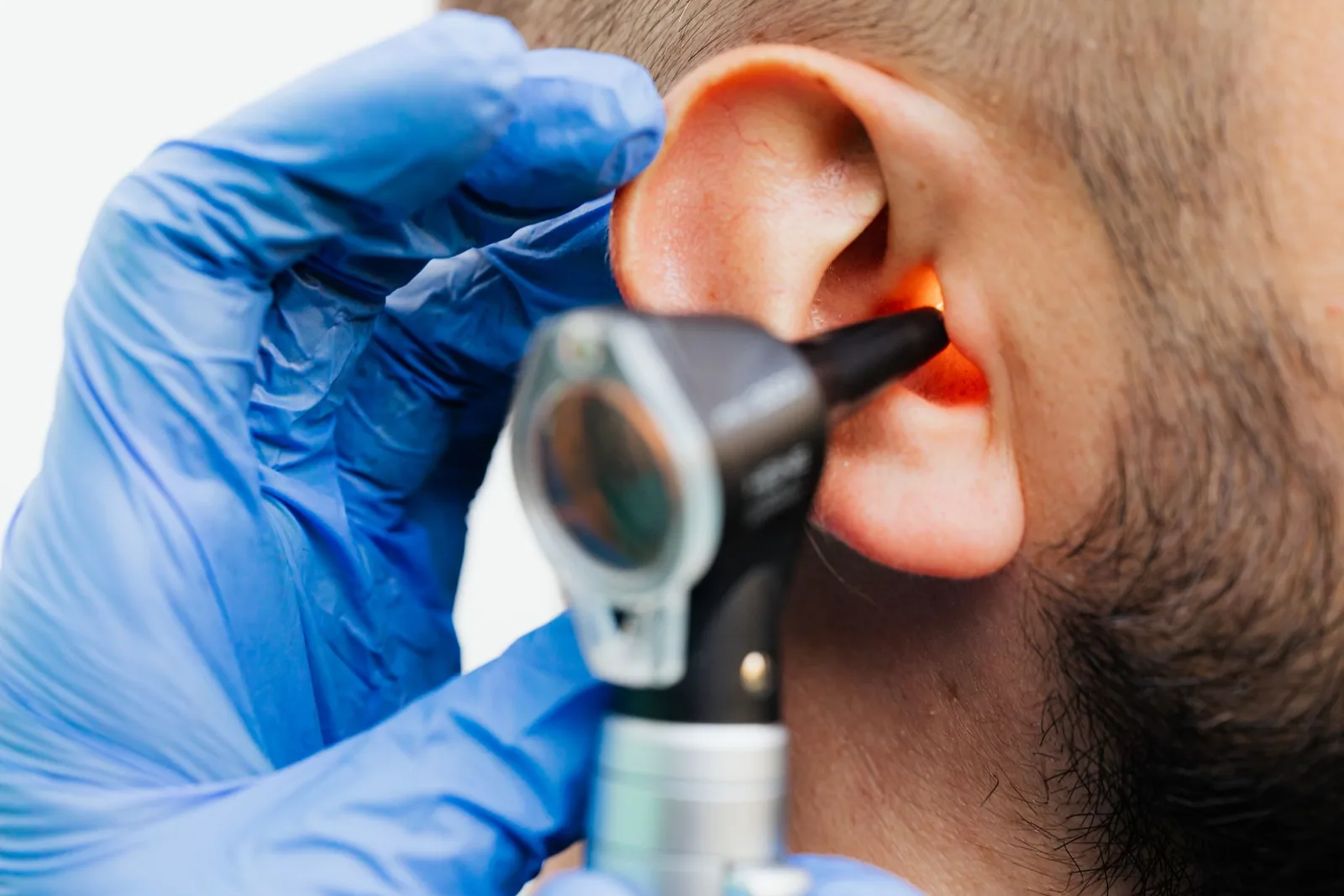 Noise-induced hearing loss expert witness — Clinical ear examination with an otoscope
