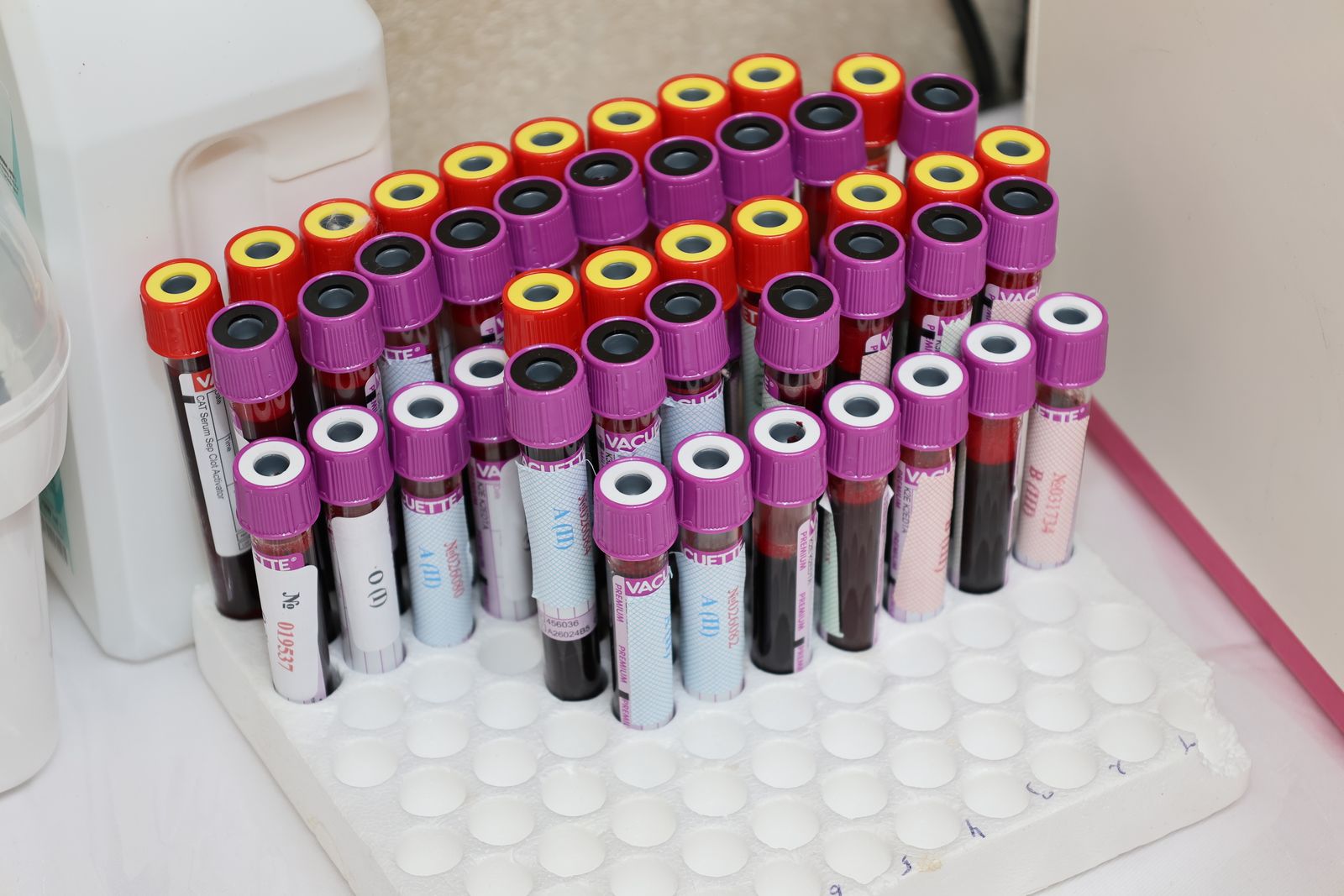 Rack of labelled blood samples in a laboratory, the material haematology expert witnesses interpret