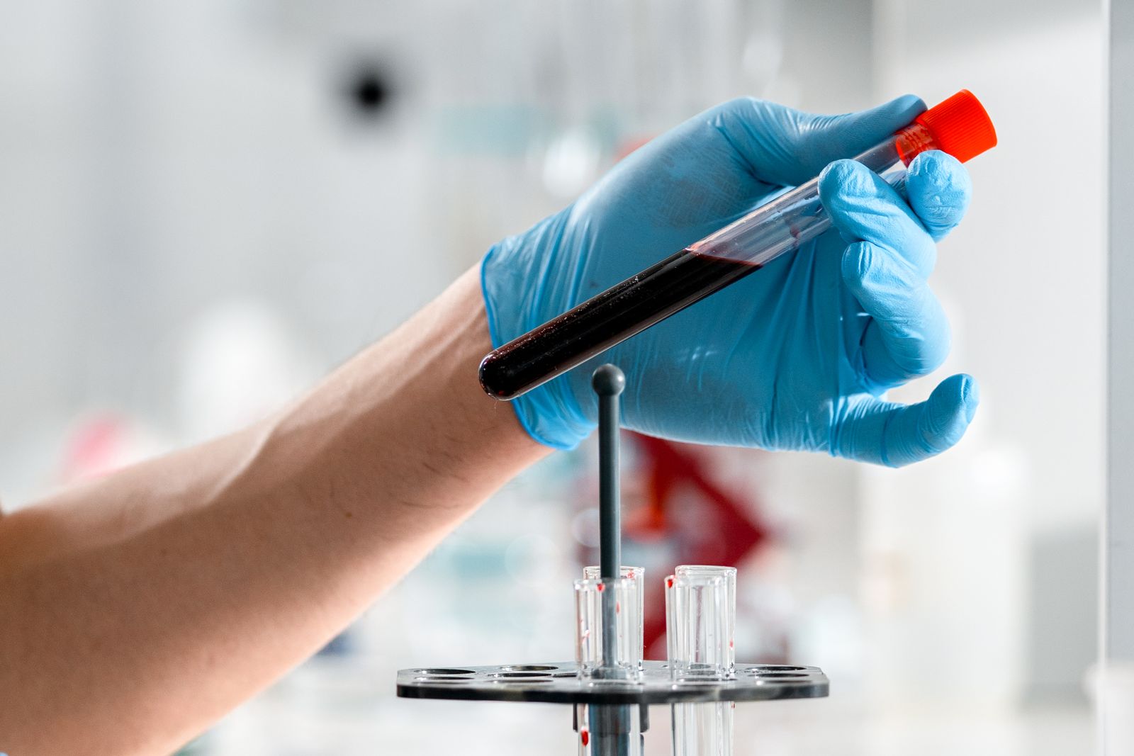 Gloved hand holding a blood sample tube, the testing HIV expert witnesses give evidence about