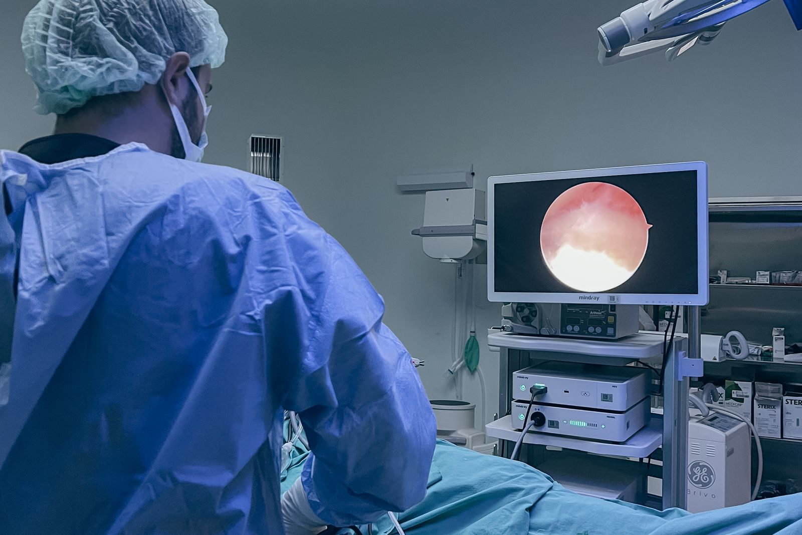 Clinician viewing an endoscopy stack monitor in theatre, the practice endoscopy expert witnesses review