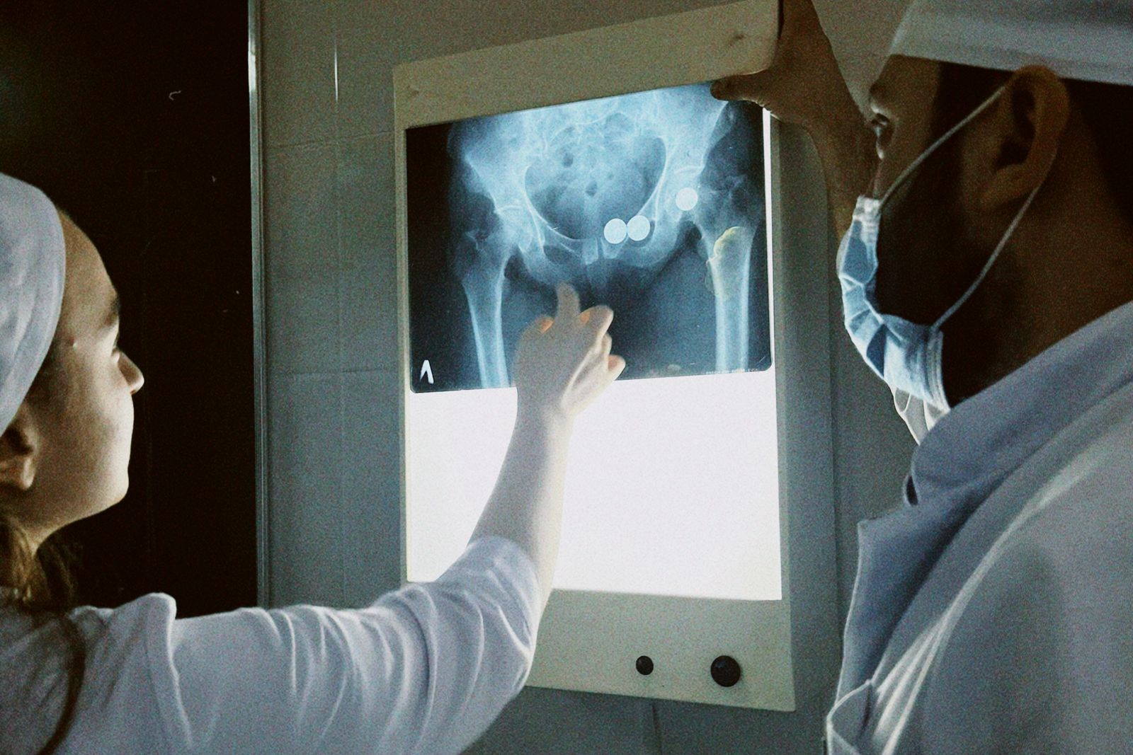 Clinicians reviewing a hip radiograph on a lightbox, the imaging hip surgery expert witnesses interpret