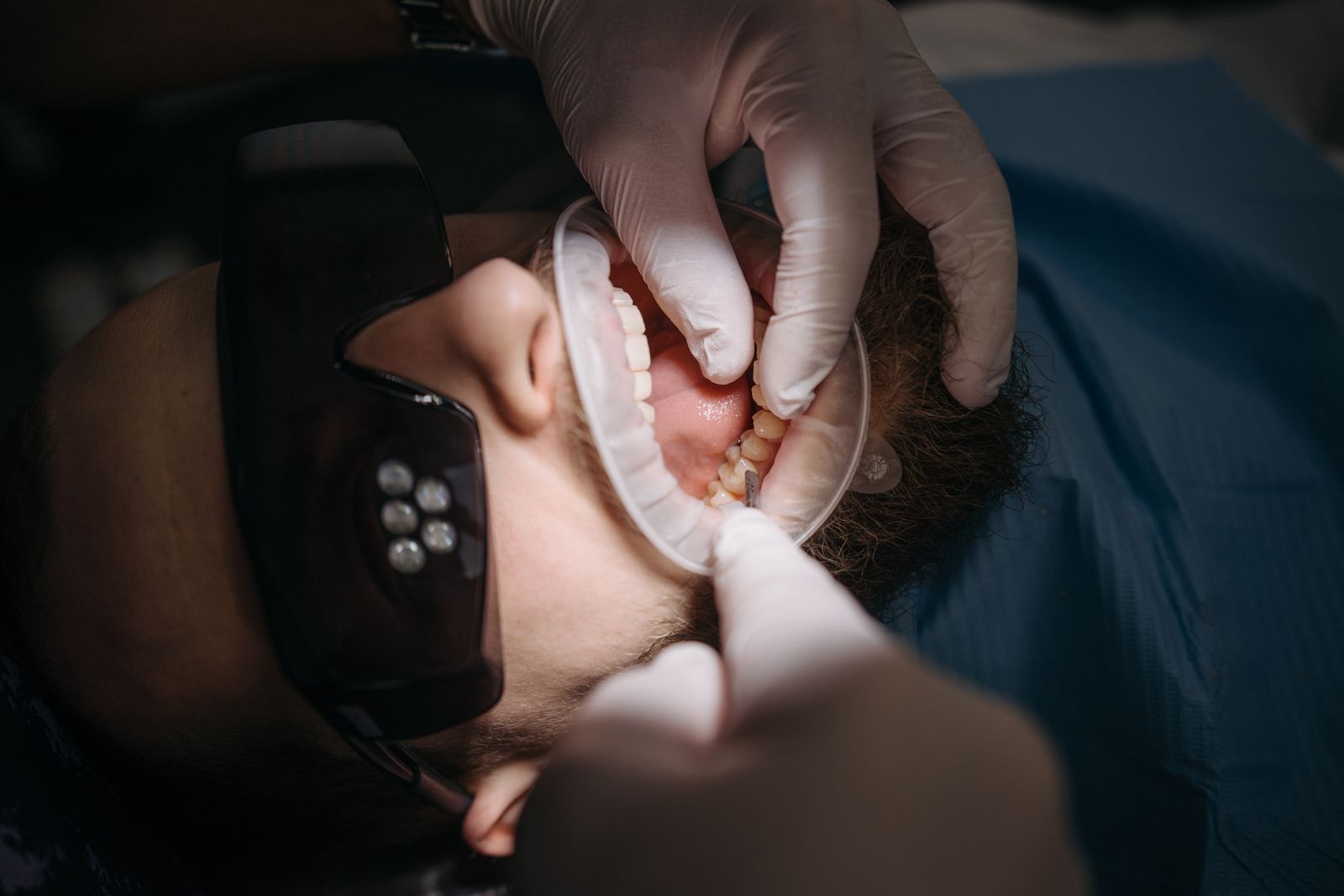 Dental treatment in progress with instruments and retraction, the care periodontics expert witnesses assess