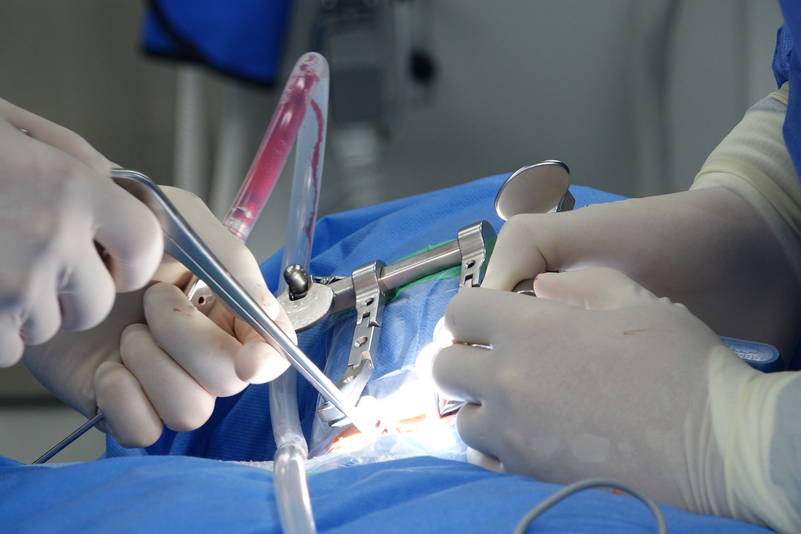 Surgical field during a spinal operation, the practice spinal surgery expert witnesses examine